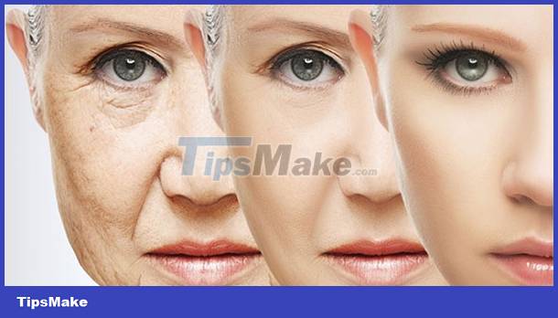 Look at the face and guess the disease Picture 2