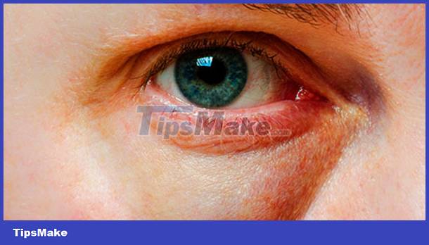 Signs on your face help identify your health Picture 12