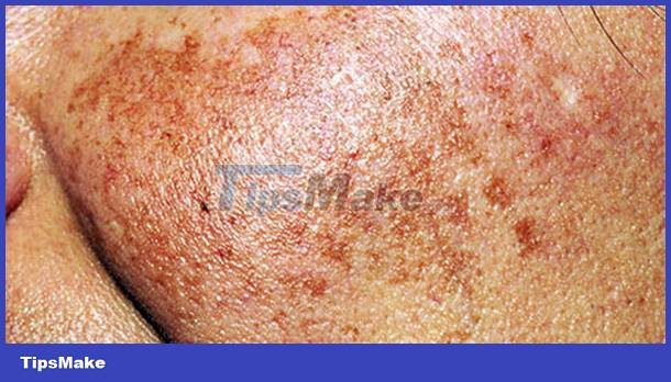 Signs on your face help identify your health Picture 13