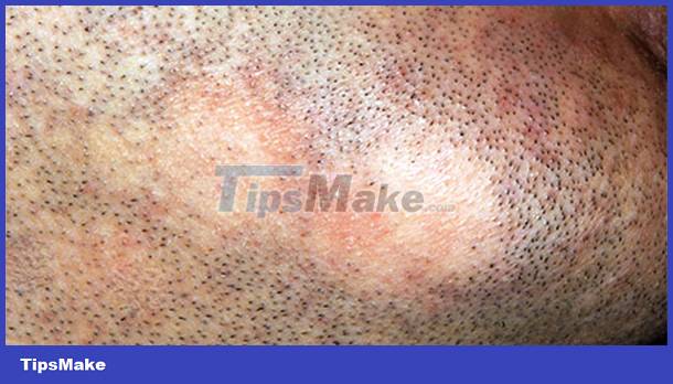 Signs on your face help identify your health Picture 14