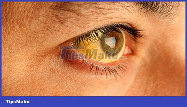 Signs on your face help identify your health Picture 2