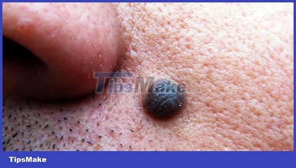 Signs on your face help identify your health Picture 3