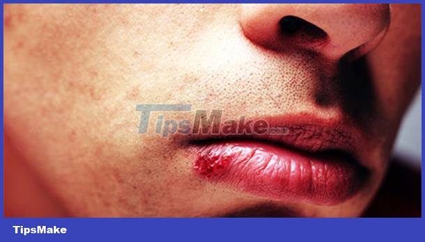 Signs on your face help identify your health Picture 4