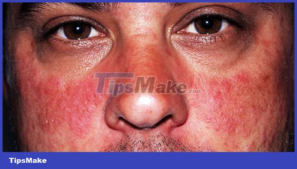 Signs on your face help identify your health Picture 6