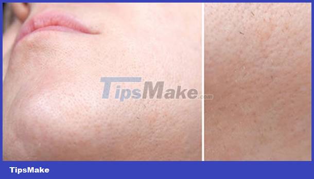 Signs on your face help identify your health Picture 7