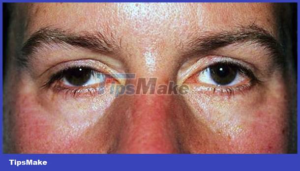 Signs on your face help identify your health Picture 8