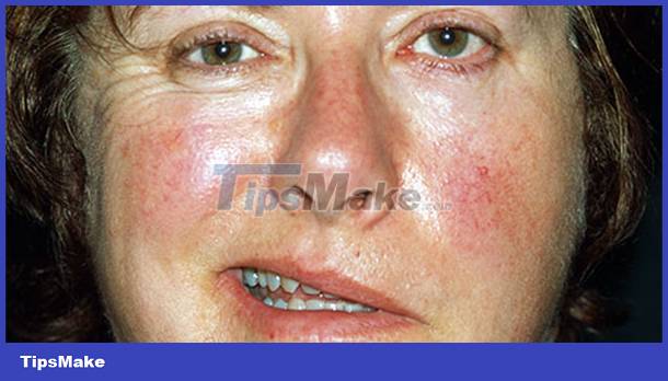 Signs on your face help identify your health Picture 9