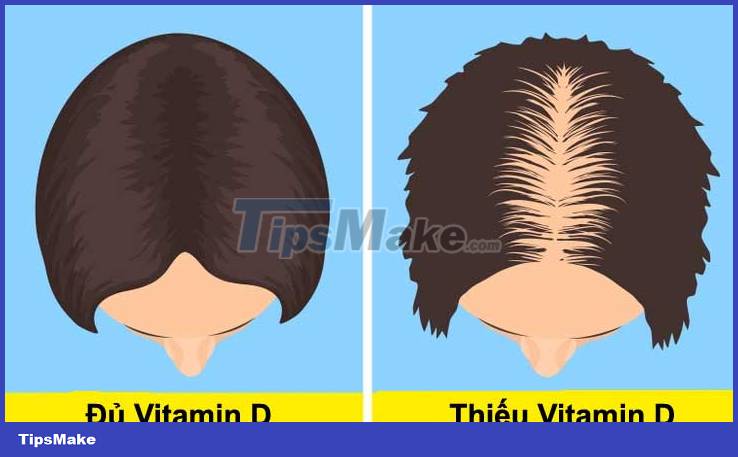 Picture 1 of Warning signs that you are lacking Vitamin D
