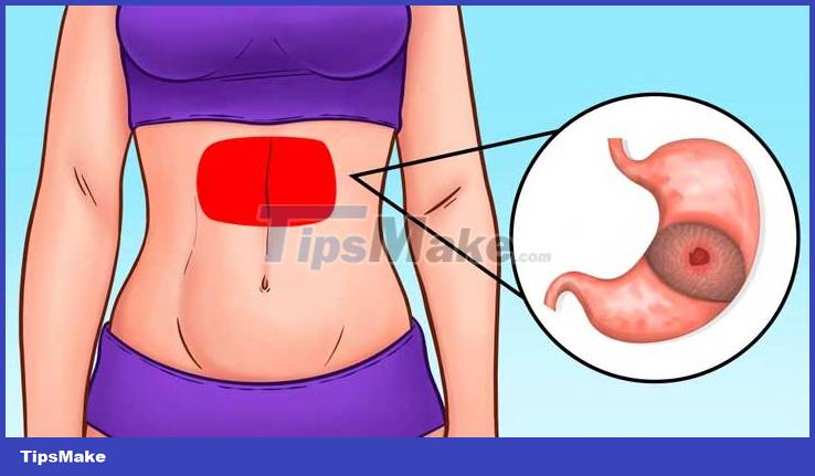 What does the location of your stomach pain reveal about your health? Picture 3