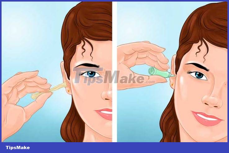 Why should you not remove earwax with a cotton swab? Picture 2