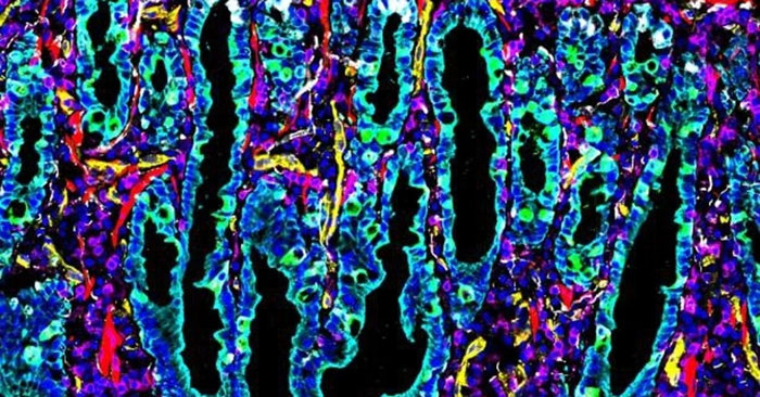 Human Intestine Map: Complete Guide