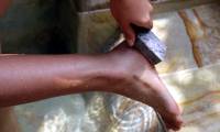 How to treat some diseases of the feet