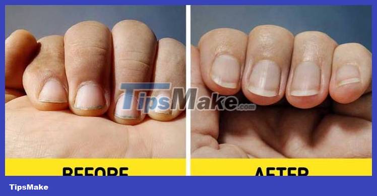 Simple ways to reuse expired products Picture 4