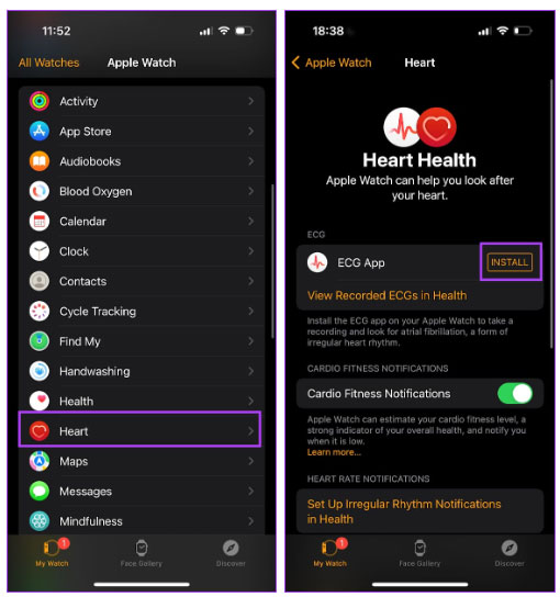 How to activate and use the ECG feature on Apple Watch Picture 3