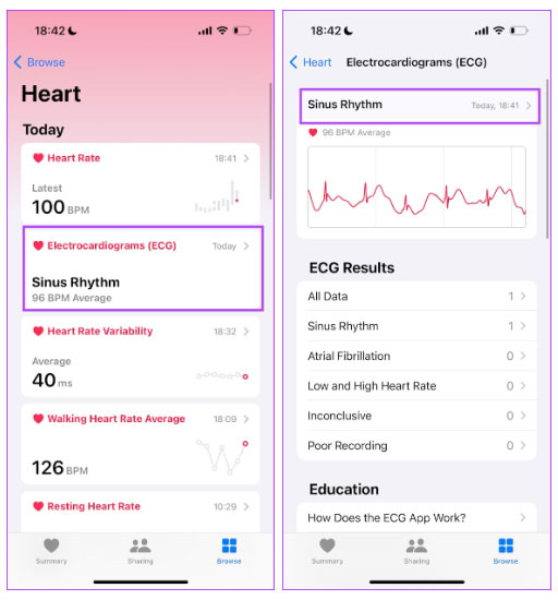 How to activate and use the ECG feature on Apple Watch Picture 6