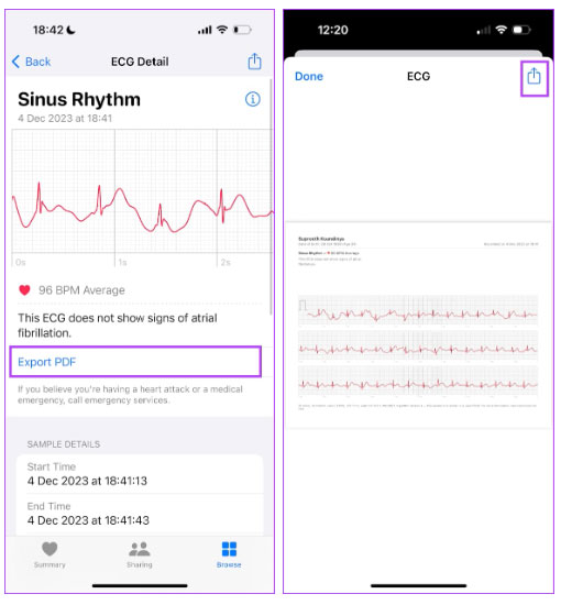 How to activate and use the ECG feature on Apple Watch Picture 7