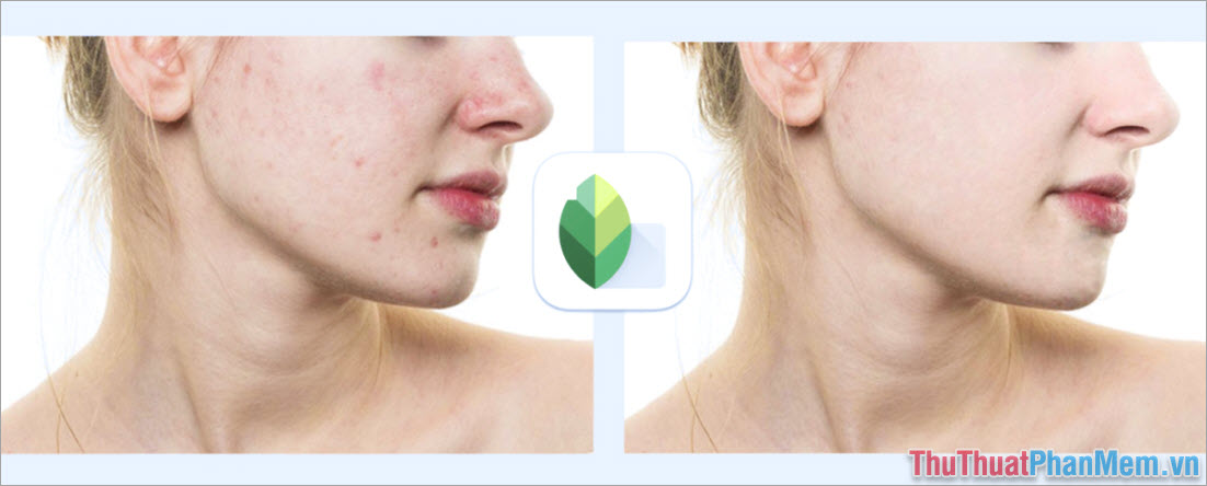 Top 5 Apps to remove acne quickly, simply, and easily Picture 5