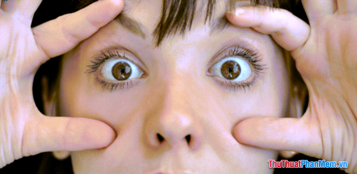 What is San Bach Eye? Revealing the mysteries of people with white eyes Picture 5