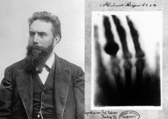 Who discovered X-rays? Picture 1