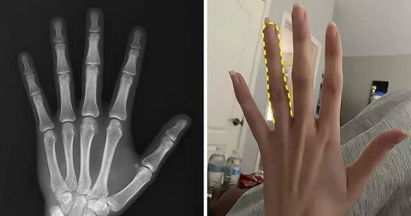 29 interesting facts about the human body that will make you exclaim 'how amazing' Picture 2
