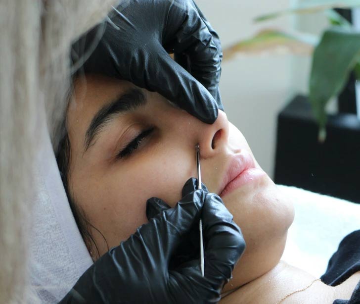 Beauty tricks that can do more harm than good Picture 2