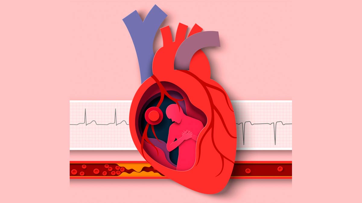 Causes of sudden increase in cholesterol in the body Picture 3