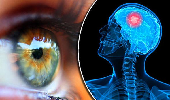 Eye changes may signal cancer, diabetes and high blood pressure Picture 2