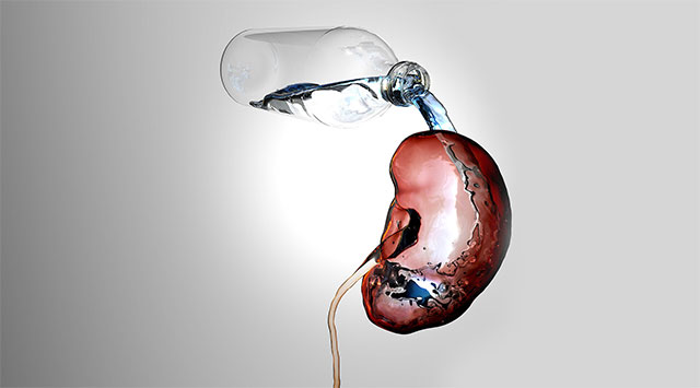 'Diabetes' Has Nothing to Do with Sugar: The Truth About Diabetes Insipidus Picture 1