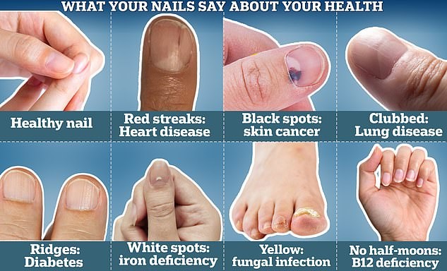 Harvard doctor reveals signs on fingernails predict longevity Picture 2