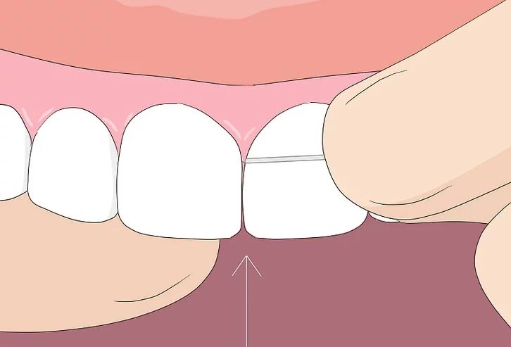 How to use dental floss Picture 2
