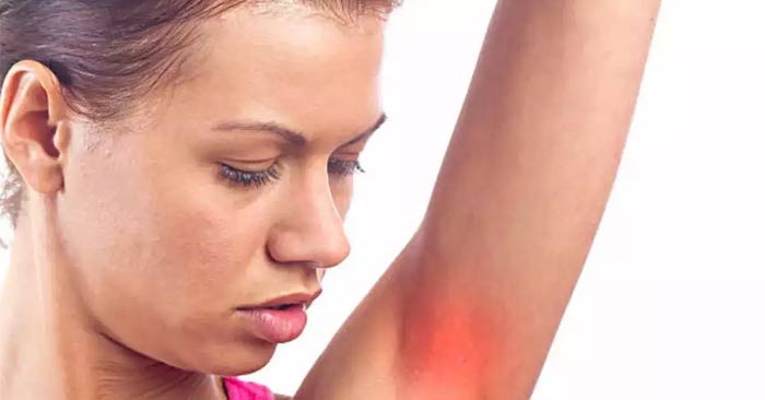 Is armpit itching a warning sign of cancer? Picture 1