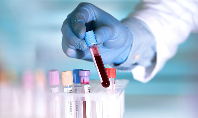 New blood test can detect cancer 3 years before symptoms appear Picture 1