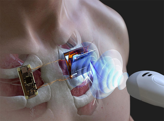 New technology can charge electronic devices underwater and even through the skin Picture 1