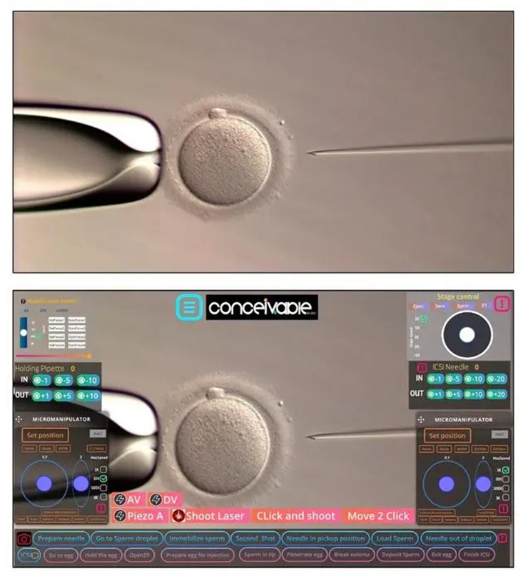 The first baby born through AI-assisted conception Picture 3