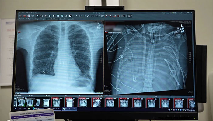 Picture 1 of Man survives 48 hours without lungs: An unprecedented medical miracle.