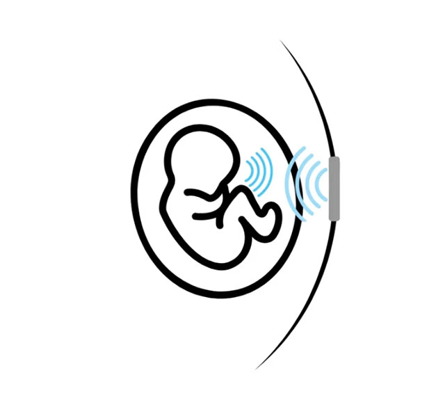 This app can turn your smartphone into a fetal heart rate monitor: How accurate is it? Picture 2
