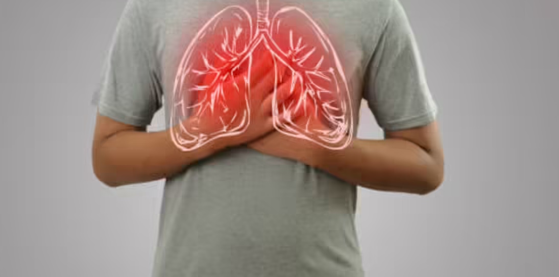 Vitamin C acts as a 'shield' protecting the lungs from common damage caused by air pollution. Picture 3