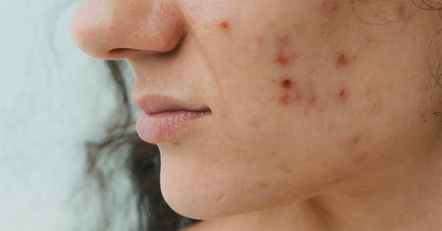 Warning signs of high cortisol and how to fix it Picture 2