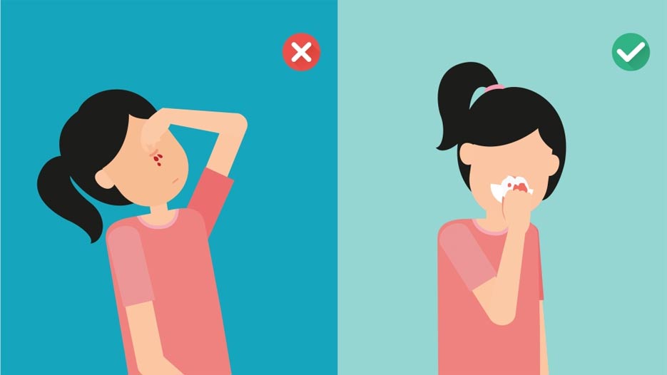 What is the disease of spontaneous nosebleed? Picture 2