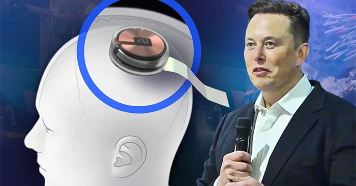 Can Neuralink's Brain Chip Be Hacked?: Features, Uses, and