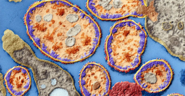 Cancer Treatment with Virus, a New Breakthrough in Medicine?