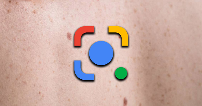 Google Lens Has Been Updated with Skin Condition Detection