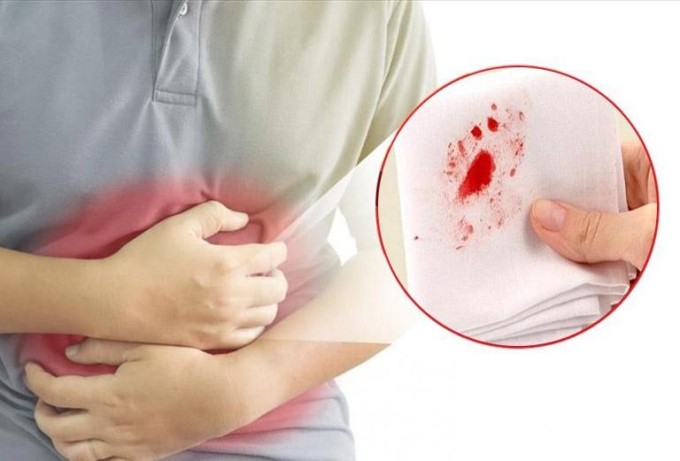 People with Malignant Tumors Often Have 6 Symptoms
