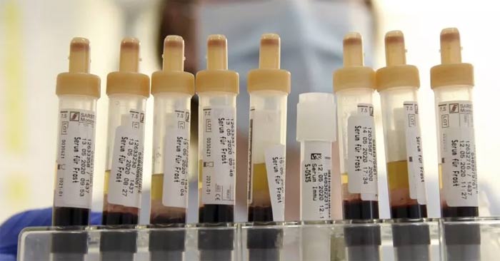 What You Need to Know About the New Blood Type: Gwada Negative