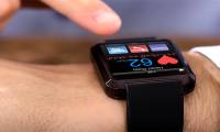 AI system uses smartwatches to detect potential health risks early with high accuracy