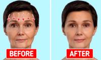 Effective exercises to remove wrinkles and rejuvenate the skin