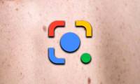 Google Lens has been updated with skin condition detection features
