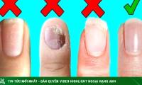 Harvard doctor reveals signs on fingernails predict longevity