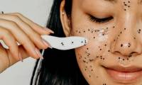 How to treat blackheads at home