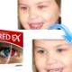 Fix red eye in photos with Ashampoo Red